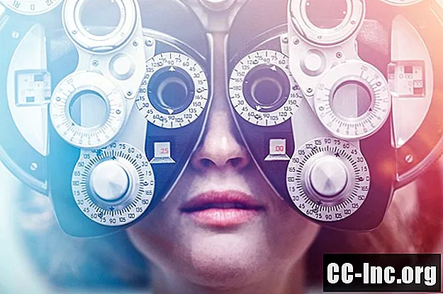 Varför debiterar ögonläkare mer för kontaktlinsprover? - Medicin