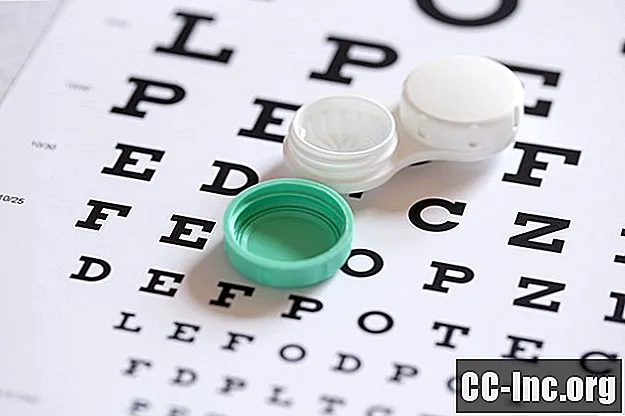 콘택트 렌즈 처방이 만료되는 이유는 무엇입니까?