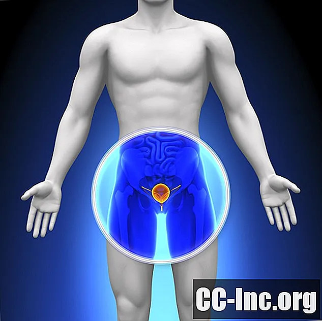 Varför tidig prostatacancer är symptomfri