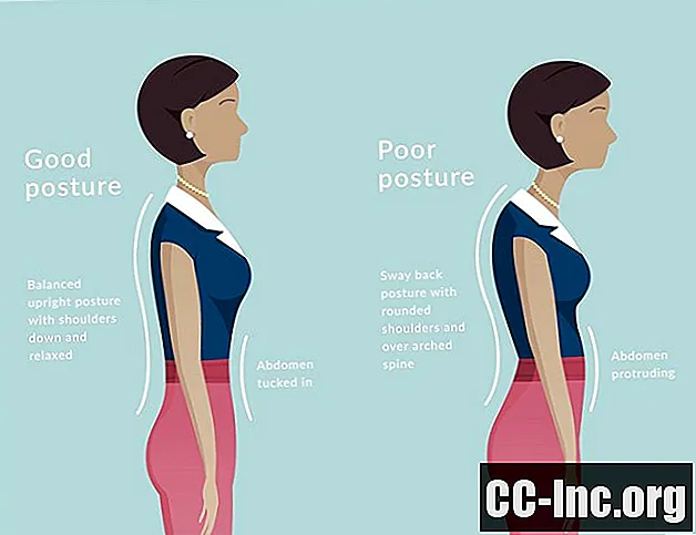 理想的な姿勢が腰痛の緩和に役立つ理由