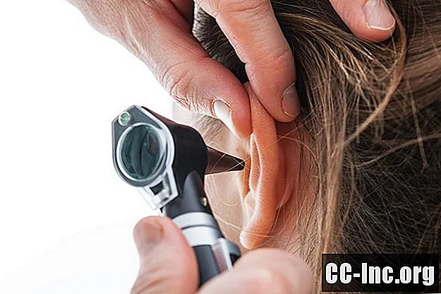 Por que você pode precisar de tubos de ouvido para tratar problemas crônicos - Medicamento