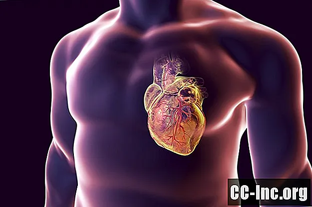 Защо е важна анатомията на коронарните артерии