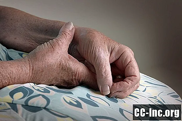 Causas e fatores de risco da artrite reumatóide
